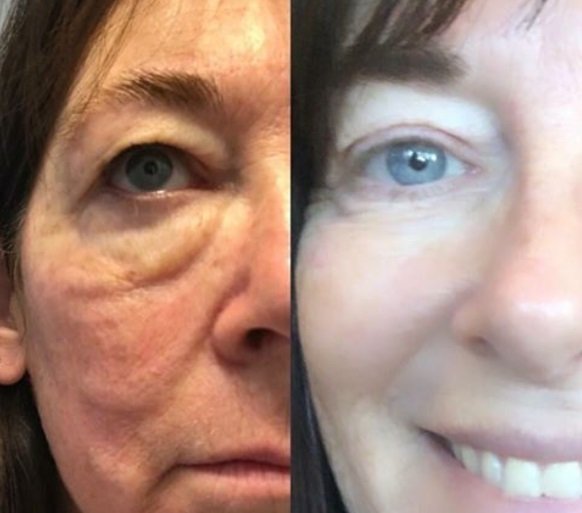 antiaging coach salon gold coast australia - Buy Modere NZ - Liquid BioCell Collagen, Shape, CellProof Skincare, Modere Shampoo, Personal Products New Zealand Shaklee Ambassador antiaging coach salon gold coast australia