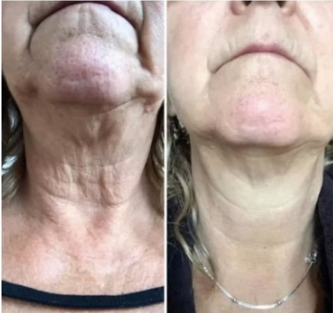 liquid biocell collagen - Buy Modere NZ - Liquid BioCell Collagen, Shape, CellProof Skincare, Modere Shampoo, Personal Products New Zealand Shaklee Ambassador liquid biocell collagen