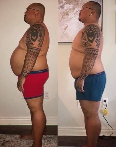 modere shape new zealand before and after photo