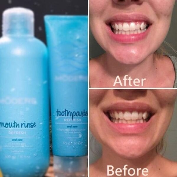modere toothpaste buy