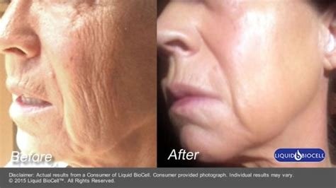oip 4174606971 1 - Buy Modere NZ - Liquid BioCell Collagen, Shape, CellProof Skincare, Modere Shampoo, Personal Products New Zealand Shaklee Ambassador oip 4174606971 1